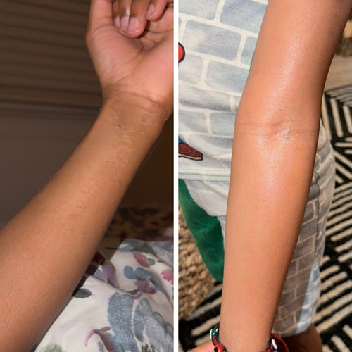 Hydrating Oasis | Kids Body Butter (For All Ages & Dry Skin)