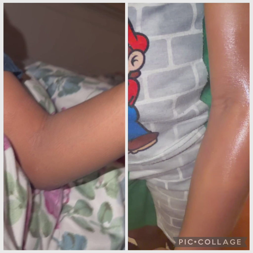Hydrating Oasis | Kids Body Butter (For All Ages & Dry Skin)